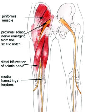 sciatic nerve roots